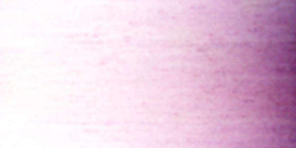 Article Picture